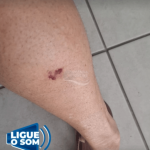 [VÍDEO] Cão que anda com a “loira dos cachorros” morde mulher no Centro de Penha